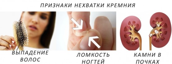 Признаки нехватки кремния в организме